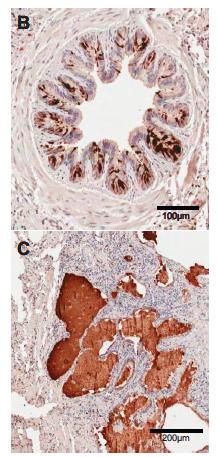 MUC5B is increased in IPF Detected in secretory columnar cells of bronchi