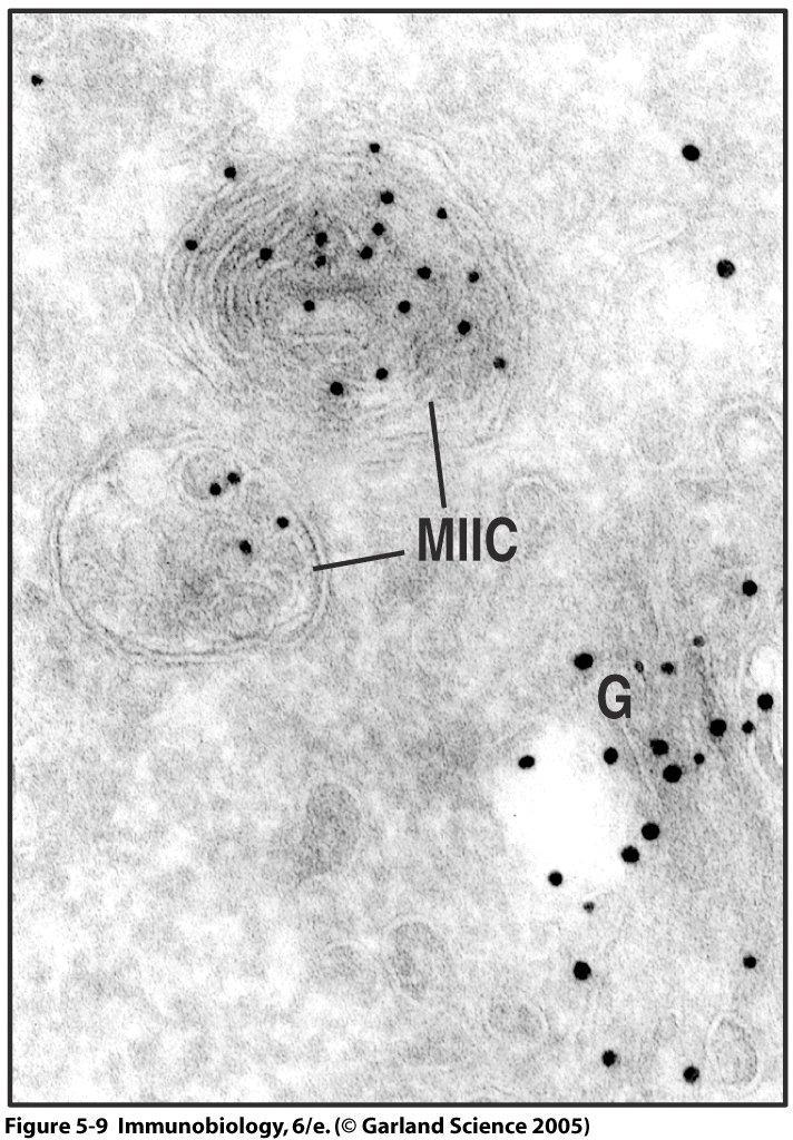 Electron microscopy studies suggest that MIIC is a specialized endolysosomal compartment in which