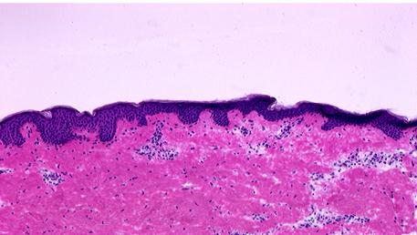 Histopathology of normal appearing