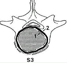 Surgical staging system Stage Definition 1 G0 T0 M0 Benign latent 2 G0 T0 M0 Benign active