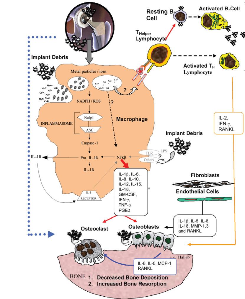 Debris-induced immune activation is primarily mediated by innate immunity = macrophages nonspecific immunity Debris-induced immune