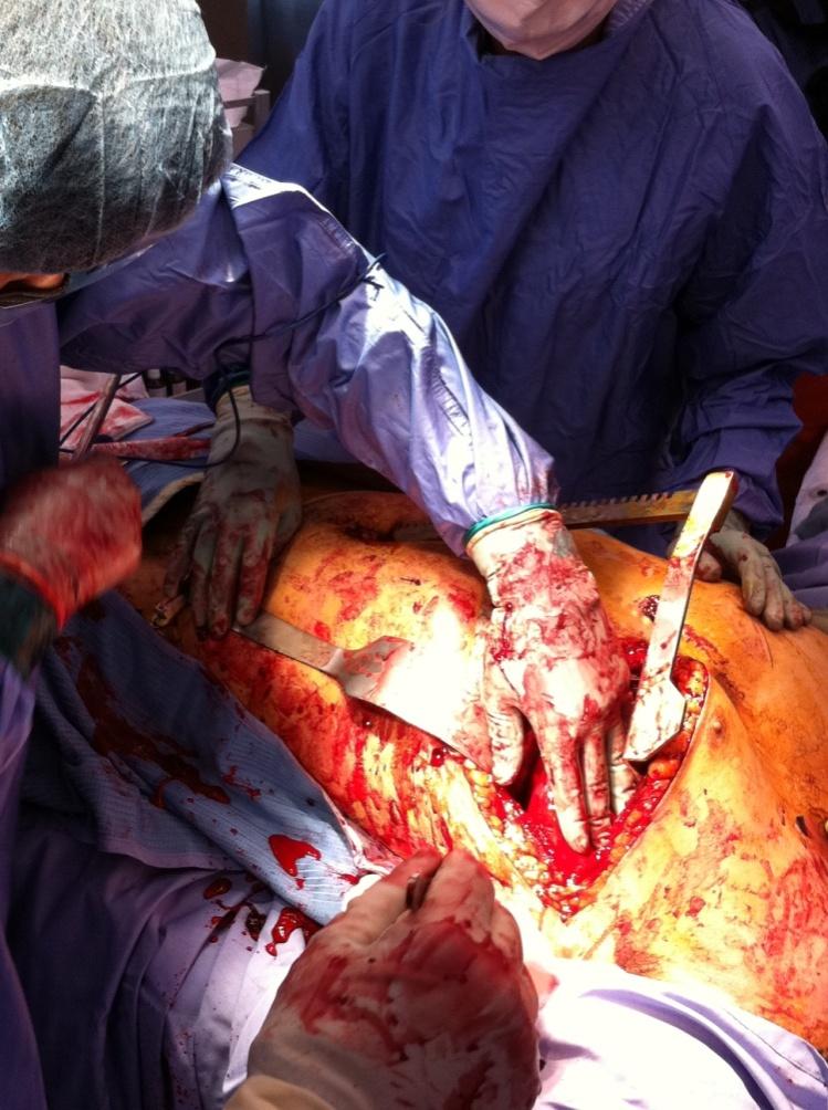 What about interventional radiology (IR) in trauma resuscitation? Bleeding anywhere!