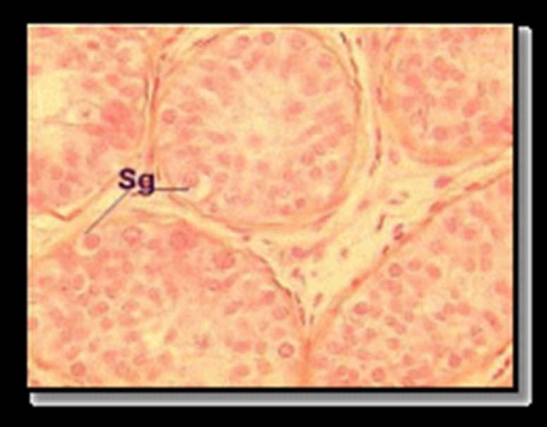 I = interstitial Sg spermatogonia Sc primary spermatocytes