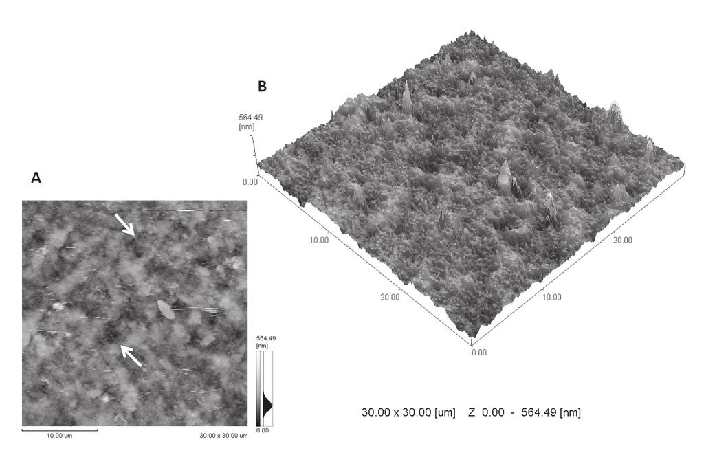 Carvalho FG, Brasil VLM, Silva Filho TJ, Carlo HL, Santos RL, Lima BASG Figure 1 - AFM image of enamel surface after erosive challenge and application of no agent; (A) ( ) honeycomb-like structure of