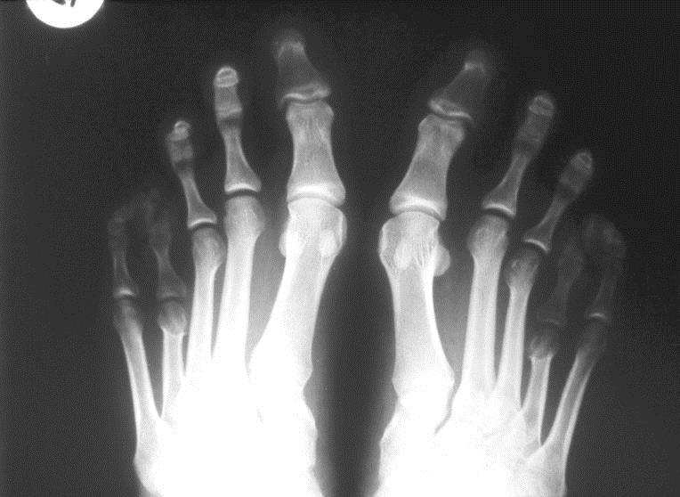 A 17-YEAR-OLD FEMALE WITH CONGENITAL