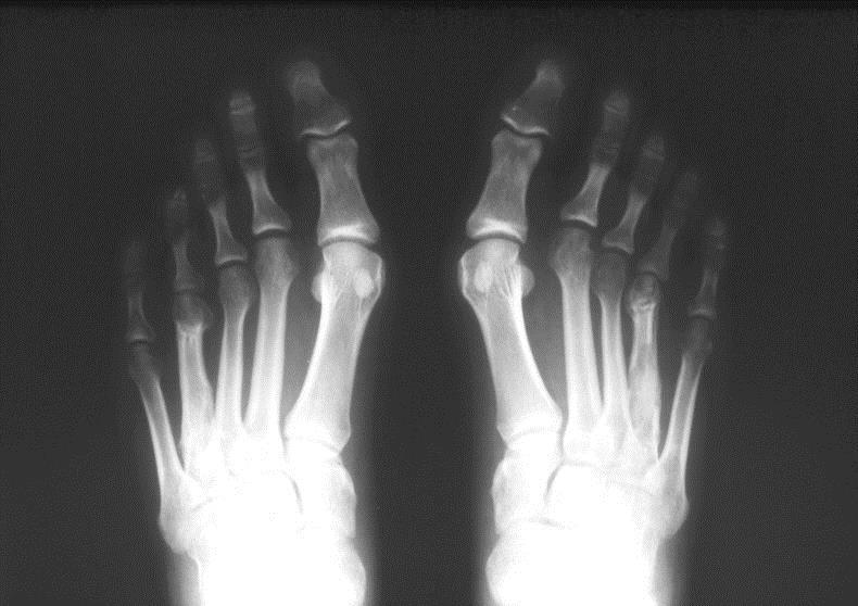 Radiograph showing the