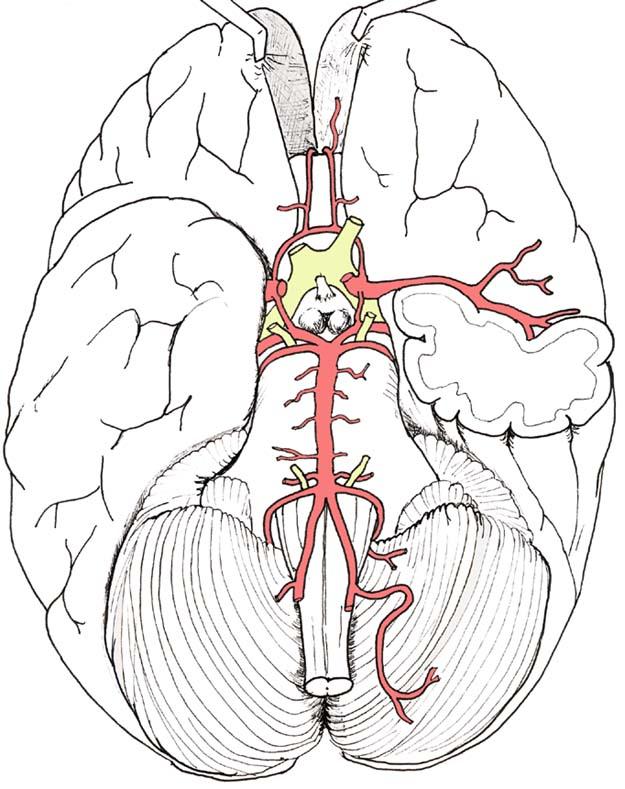 Middle cerebral artery About two-thirds of all ischemic stroke occurs in the middle cerebral artery territory MCA stroke can