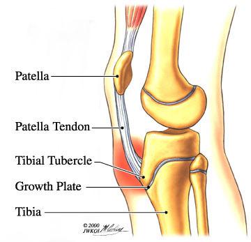 Patellar Instability OVERVIEW You have been diagnosed with patella instability.