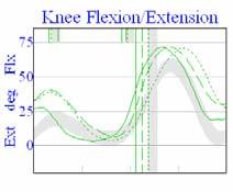 knee extension in terminal swing Excessive