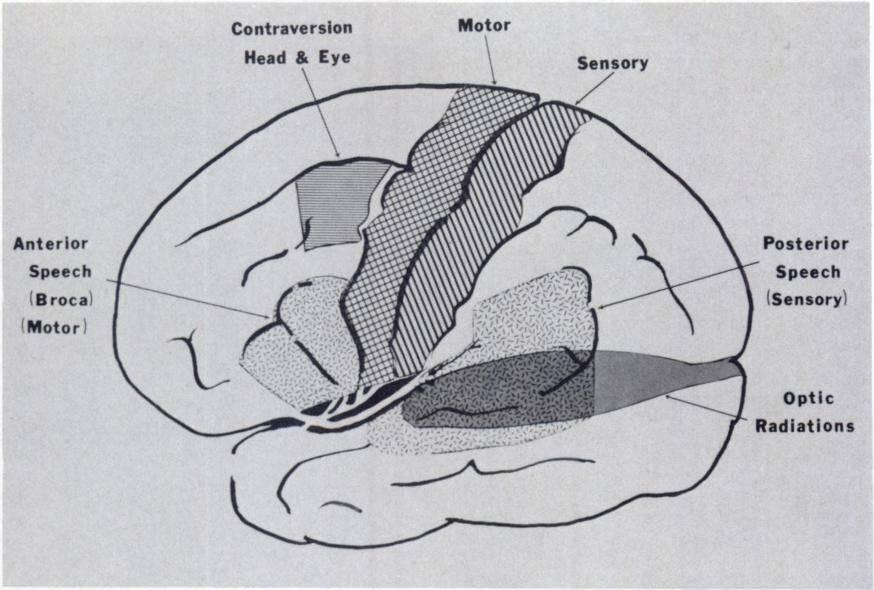 58o Altemus, Robenson, Fisher and Pessin MARCH, 3976 -.- Anterior Speech (Broca) (Motor) FIG. 7. Functional areas of dominant hemisphere.