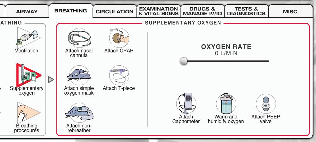 Breathing > Supplementary oxygen Menu: Supplementary oxygen Presents options for different oxygen supplements.