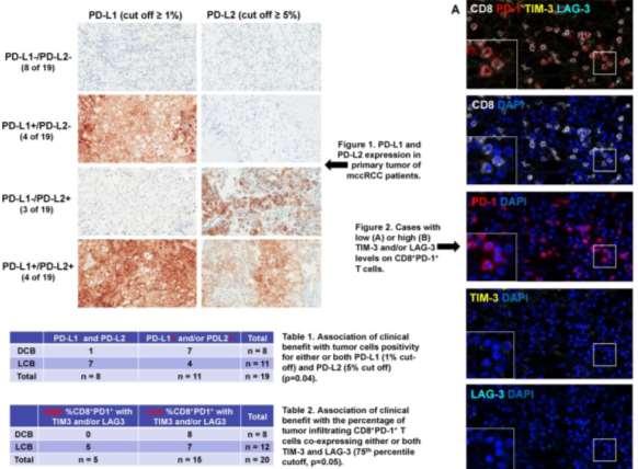 Impact of immune checkpoint protein expression in tumor cells nd tumor infiltrating CD8+ T cells on clinical benefit from PD-1 blockade in mrcc