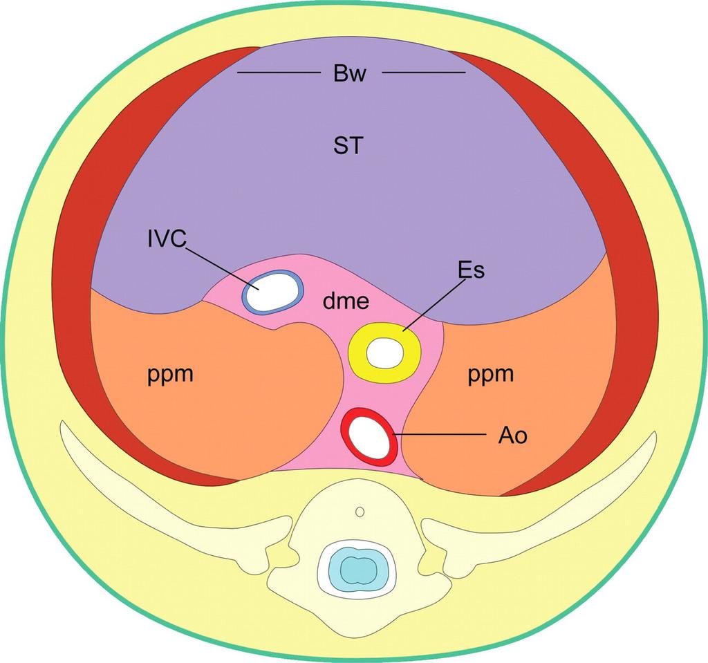 Fig.: Embryology of the diaphragm References: Restrepo CS, Eraso A, Ocazionez D, Lemon J, Martinez S, Lemons DF.