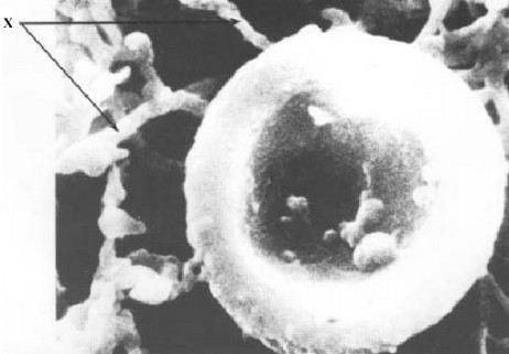 30 The photograph shows a red blood cell in part of a blood clot. The fibres labelled X are produced in the early stages of the clotting process.