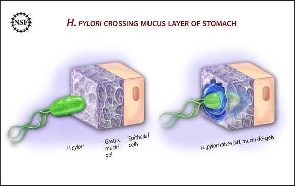 Ulcers form when H. pyloribacteria infect the stomach, causing holes in the mucin.