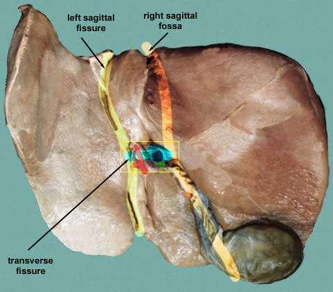 Separation of the four lobes of the liver: Right sagittal fossa - groove for inferior vena cava and gall bladder left sagittal fissure -