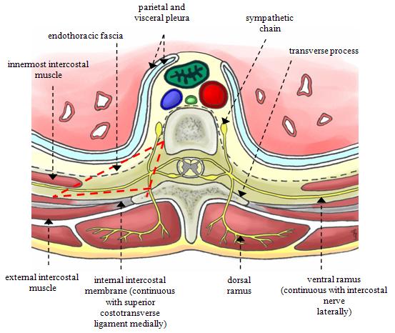 Peripheral Nerve Block Examples Thoracic paravertebral Transversus abdominus plane (TAP) Lower extremity femoral, popliteal, sciatic, fascia iliaca,