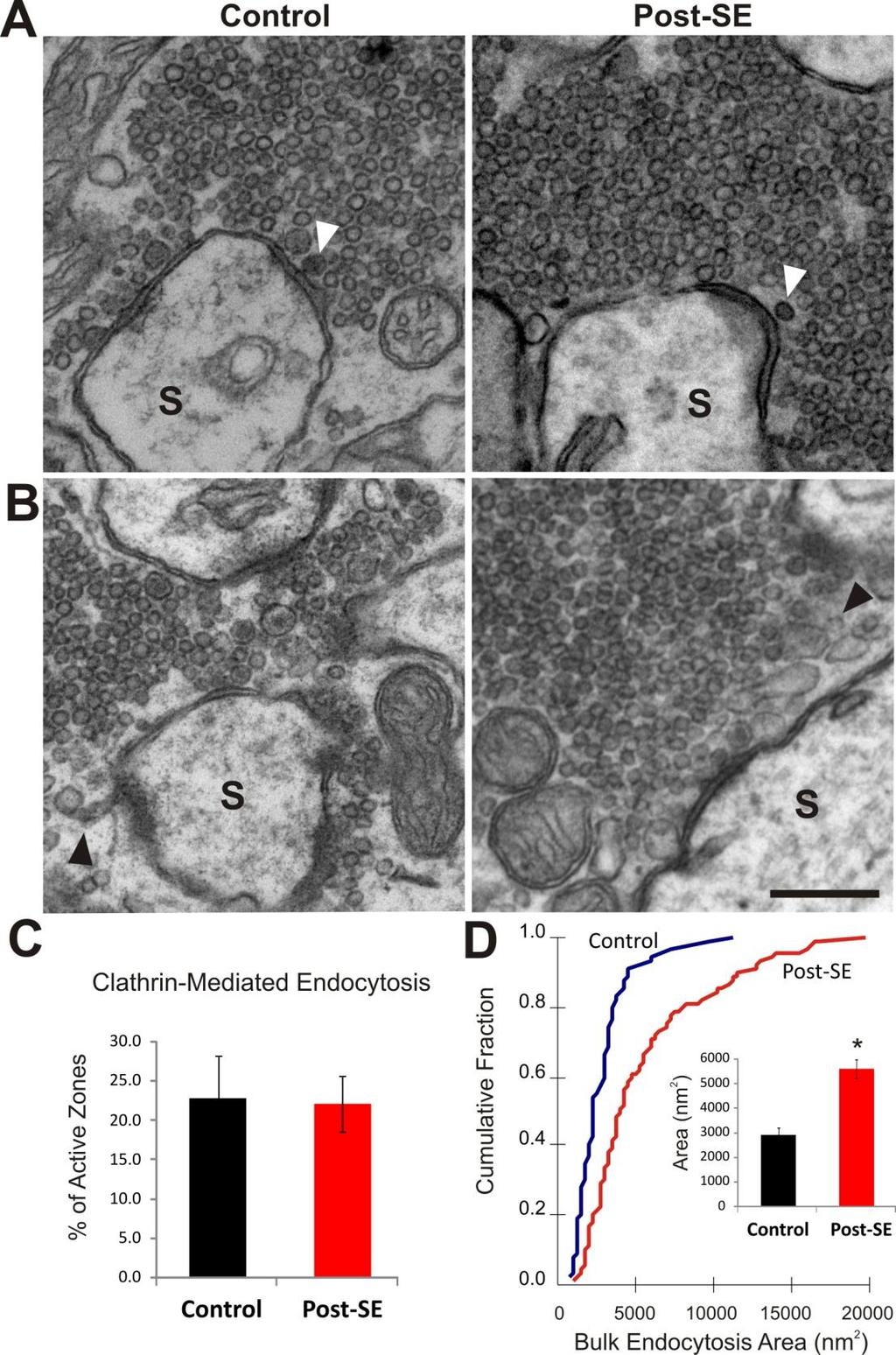 Fig. 5. Representative TEM images of active zones (AZs) in MFBs exhibiting structural signs of clathrin-mediated endocytosis and bulk endocytosis in control and epileptic rats.