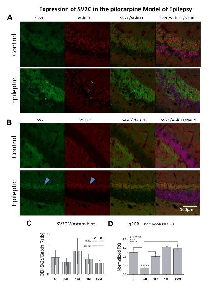Figure 24.3. SV2C expression was up-regulated in chronically epileptic rats. A.