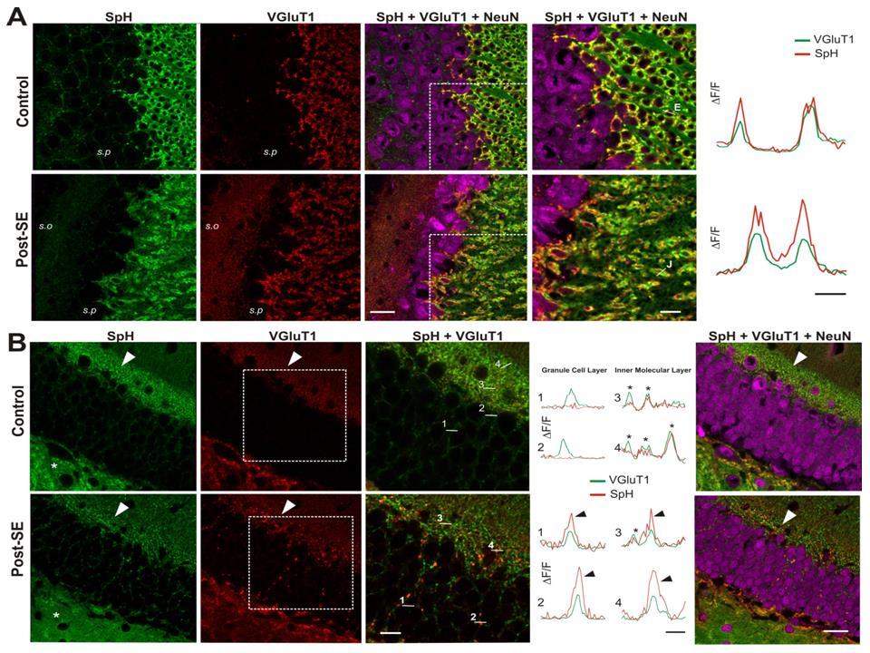 1.1.2. Pilocarpine-induced status epilepticus causes disorganization of dentate gyrus and CA3 cytoarchitecture in SpH mice. In the hippocampal CA3 region of both control (Fig.