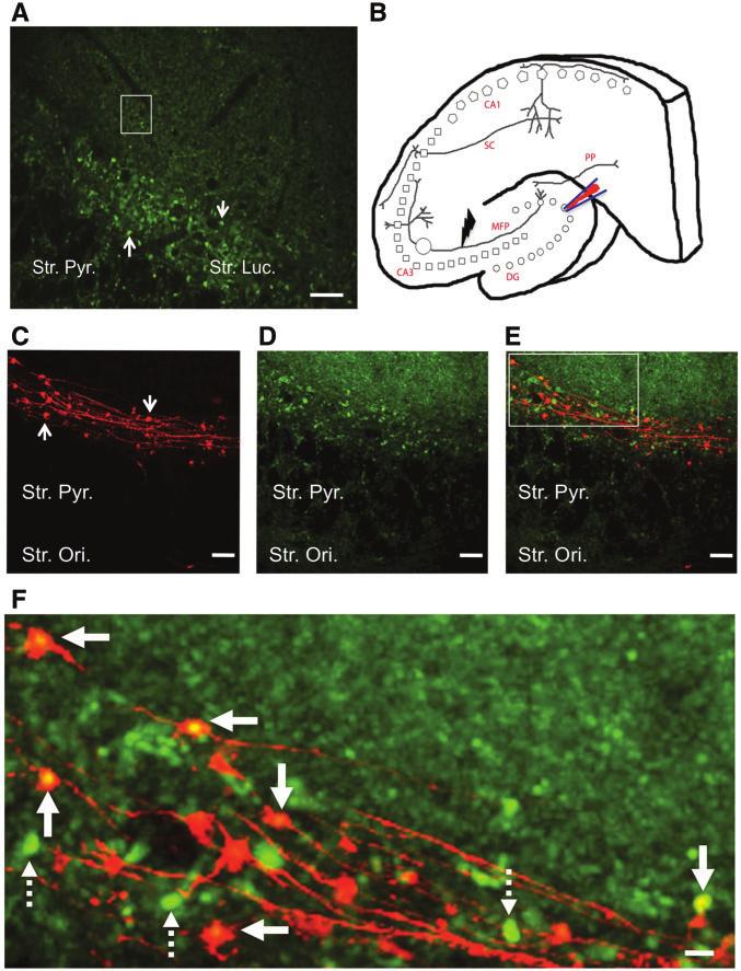 Abnormal pre-synaptic structure and function in epilepsy Brain 2012: Page 5 of 17 5 Figure 1 Visualizing MFBs in acute hippocampal slices from SpH21 transgenic mice.