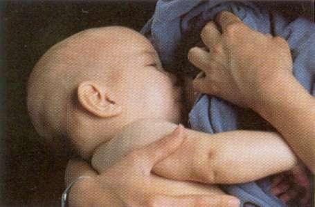 Infant Feeding Breast feeding will not