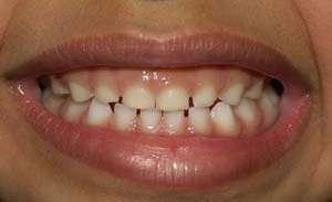 What is Oral Health Focuses on the Mouth or oral cavity