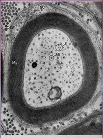 25 Schwann cells Mature myelin in the