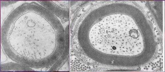 Myelinating Neuroglia CNS Oligodendrocytes Form multiple myelin sheaths around one or more axons Radial glia Astrocytes Regulate extracellular brain fluid composition