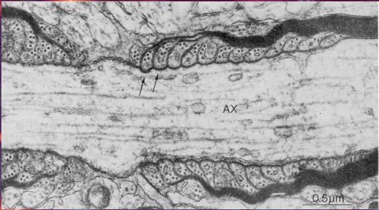 Oligodendrocytes & CNS myelin Mature myelin in the