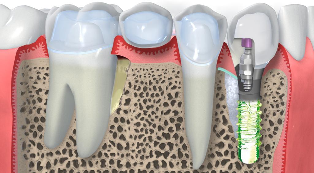 Straumann serves three dental specialty segments.