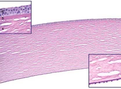 Shield 44 VII. FIGURES Figure 1: Corneal microarchitecture in cross section, from Robbins Pathology 7 th ed.