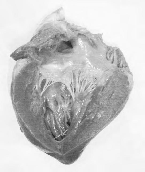 5 Fig. 5.1 shows a vertical section of the left side of the heart of a mammal.