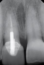 Intraoral radiography has very good diagnostic capability for dental pathology as well as structure and density assessment in the superior-inferior and mesial-distal plane. 4.
