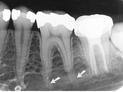 space between the mandibular incisors black patients; male patients; older