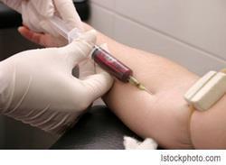 Interferon Gamma Release Assays Tuberculin Skin Test (TST) Each