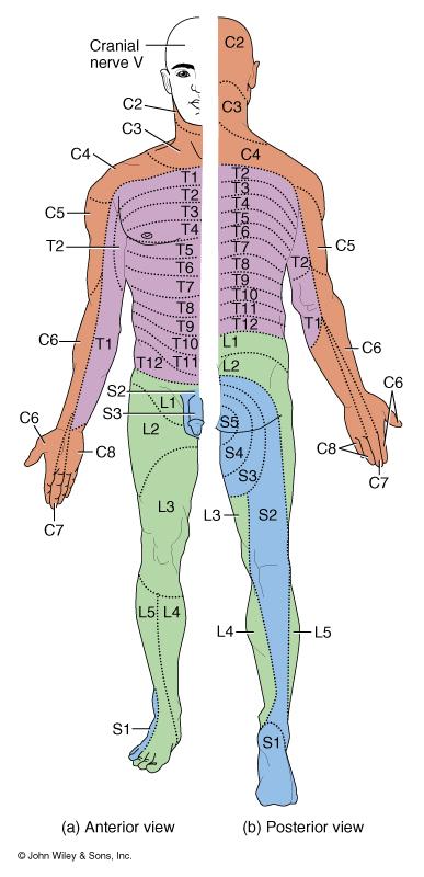 Dermatomes Disorders Damaged regions of the spinal cord can be distinguished by patterns of numbness over a dermatome