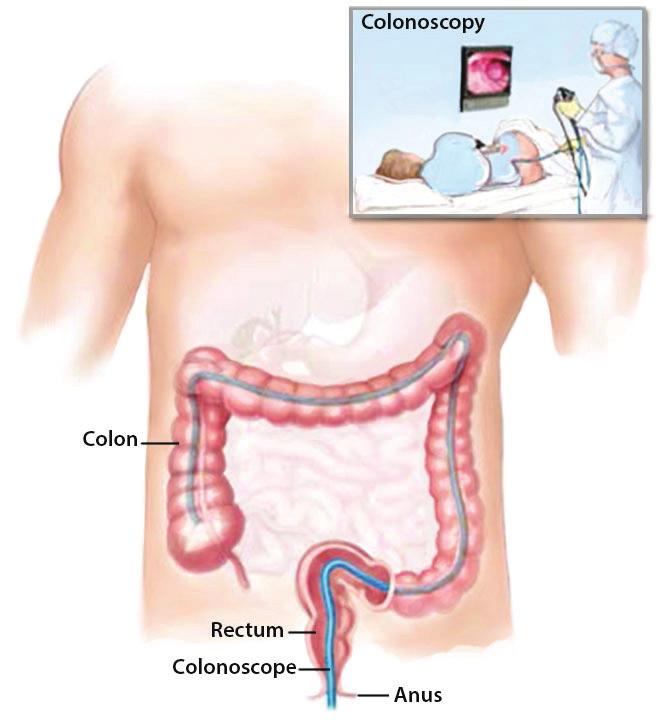 At the Time of Your Visit When you are seen by the colorectal specialist, you will be asked several questions with respect to your history.
