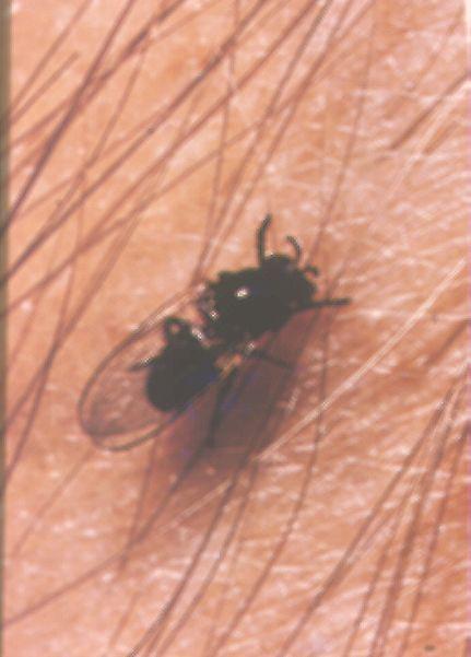Onchocerca volvulus Vector Blood sucking fly Simulium Microfilariae