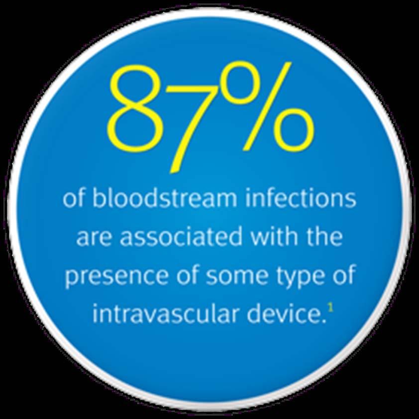 Catheter Related Bloodstream infection (CRBSI) Intravascular devices can result in bloodstream