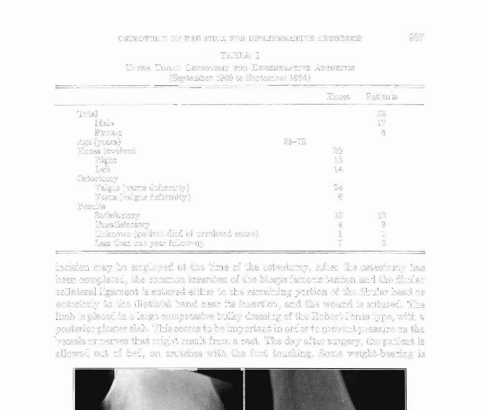 OSTEOTOMY OF THE TIBIA FOR DEGENERATIVE ARTHRITIS TABLE I UPPER TIBIAL OSTEOTOMY FOR DEGENERATIVE ARTHRITIS (September 1960 to September 1964)
