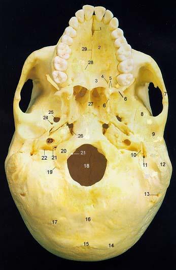 Superior Orbital Fissure 5.Inferior Orbital Fissure 6. Zygomatic Bone 7. Infra-Orbital Foramen 8. Maxilla 9. Mandible 10. Mental Foramen 11. Incisive Fossa 12.Symphysis 13.Vomer 14.