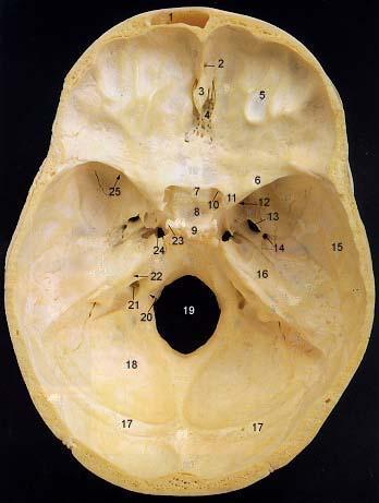 Greater Palatine Foramen 5.Lesser Palatine Foramen 6. Pterygoid Processes of Sphenoid 7.Zygomatic Process 8. Squamous Part of Temporal Bone 9. Mandibular Fossa 10. Styloid Process 11.