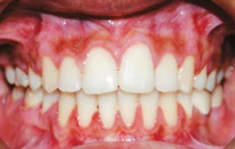 post-treatment mandibular occlusal dental photograph