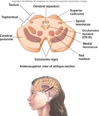 Brainstem: Midbrain Also called mesencephalon Small and superior to pons Nuclei Of cranial nerves III-V Tectum: four nuclei that form mounds on dorsal surface of midbrain.