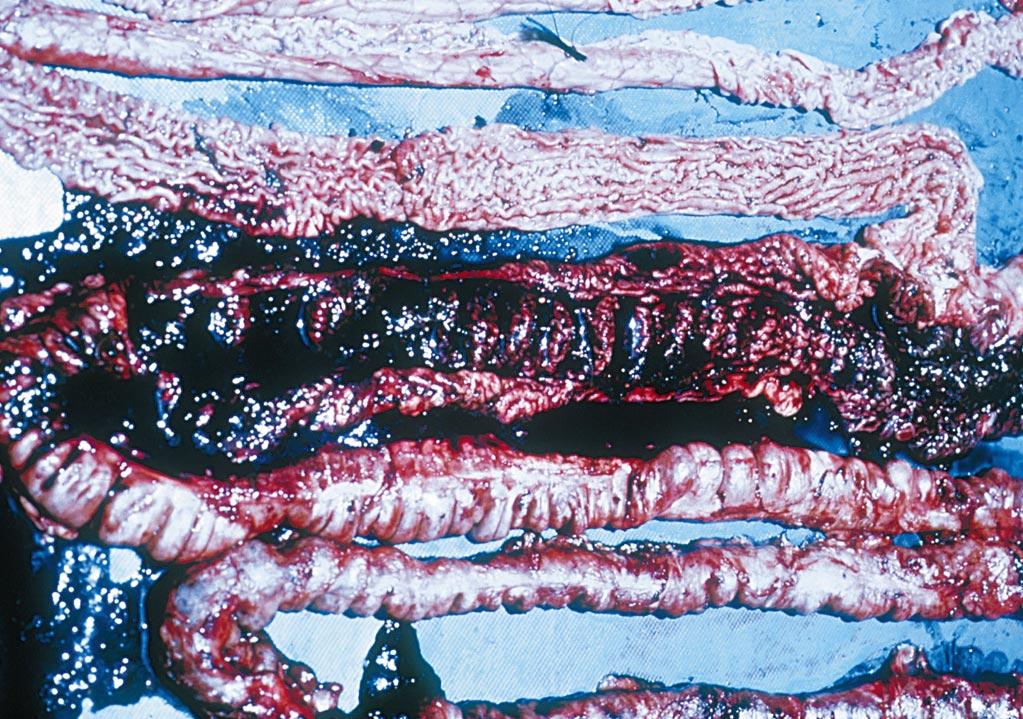 18 Post mortem findings FIGURE 16 Haemorrhagic intestines