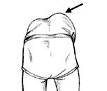 Step 5: Bending Position-Back View