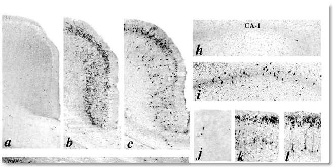 7 p rotid Midasolaam+N2O+isofluraan 6 tundi Tulemused: widespread apoptotic neurodegeneration in the developing brain,