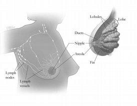 General Breast Cancer Information and Glossary of Terms Breast cancer is a disease in which malignant (cancer) cells form in the tissues of the breast. The breast is made up of lobes and ducts.
