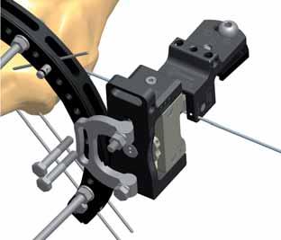 pply the Knee Hinge over the reference axis wire, making sure that